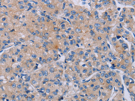 P2RX3 Polyclonal Antibody Store at -20°C