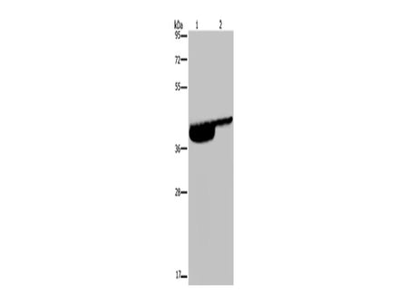 P2RX3 Polyclonal Antibody Store at -20°C