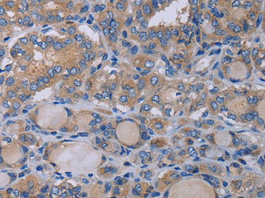 P2RX3 Polyclonal Antibody Store at -20°C