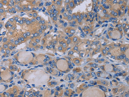 P2RX3 Polyclonal Antibody Store at -20°C