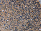P2RX2 Polyclonal Antibody