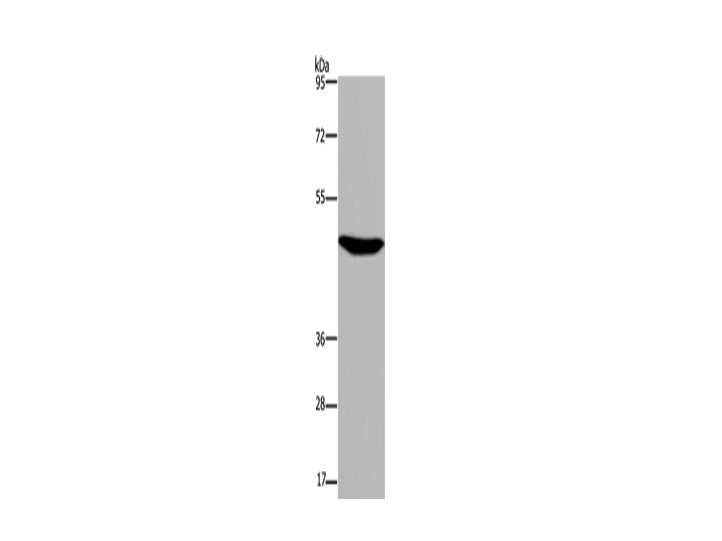 P2RX2 Polyclonal Antibody