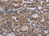 P2RX2 Polyclonal Antibody