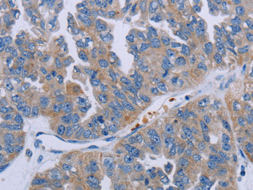 P2RY2 Polyclonal Antibody Store at -20°C