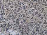 TP53AIP1 Polyclonal Antibody Store at -20°C