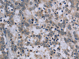 TP53AIP1 Polyclonal Antibody Store at -20°C