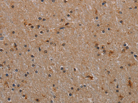 p70 S6 kinase beta Polyclonal Antibody