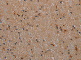 p70 S6 kinase beta Polyclonal Antibody