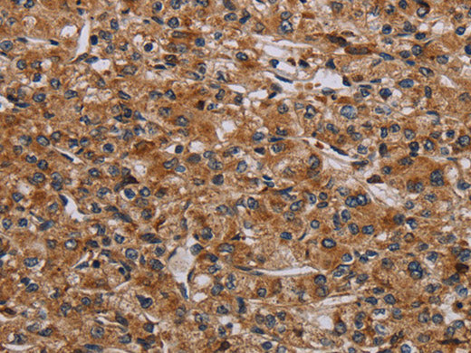 p70 S6 kinase beta Polyclonal Antibody