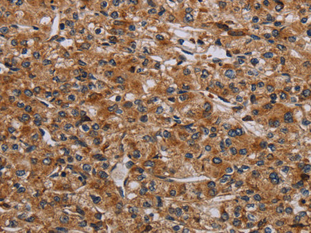 p70 S6 kinase beta Polyclonal Antibody