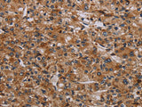 p70 S6 kinase beta Polyclonal Antibody