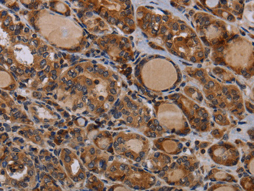 PAPPA Polyclonal Antibody Store at -20°C