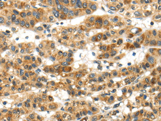PAPPA Polyclonal Antibody Store at -20°C