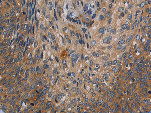 PARP10 Polyclonal Antibody Store at -20°C