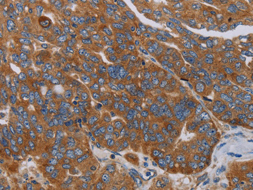 PARP10 Polyclonal Antibody Store at -20°C