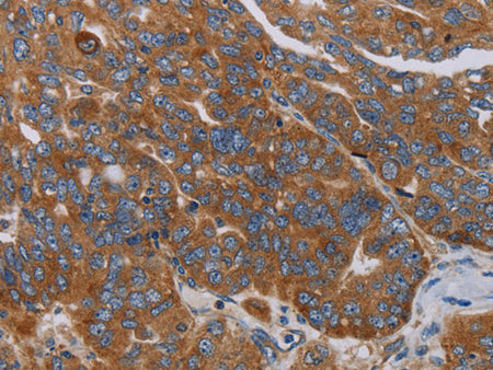 PARP10 Polyclonal Antibody Store at -20°C