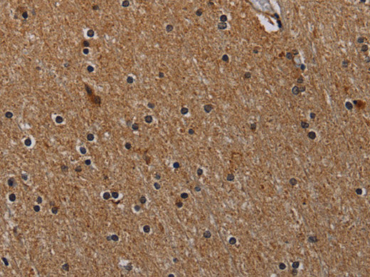 IVL Polyclonal Antibody Store at -20°C