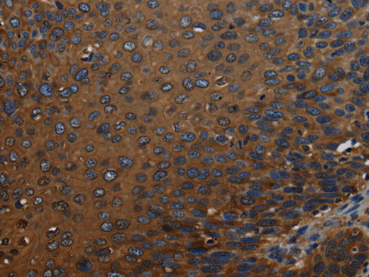 IVL Polyclonal Antibody Store at -20°C