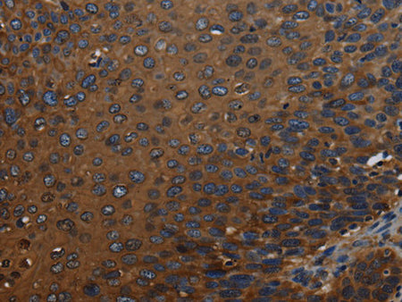 IVL Polyclonal Antibody Store at -20°C