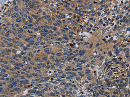 PCDHB15 Polyclonal Antibody Store at -20°C