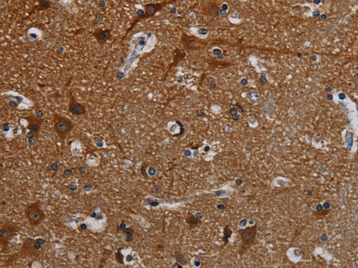PCDHB15 Polyclonal Antibody Store at -20°C
