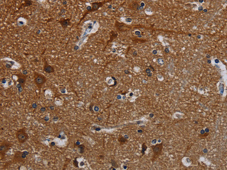 PCDHB15 Polyclonal Antibody Store at -20°C