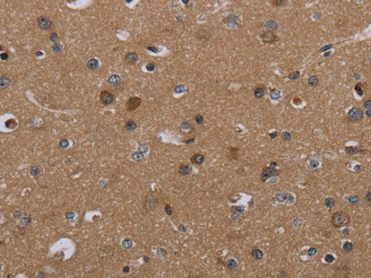 PDGFC Polyclonal Antibody Store at -20°C