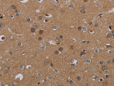 PDGFC Polyclonal Antibody Store at -20°C
