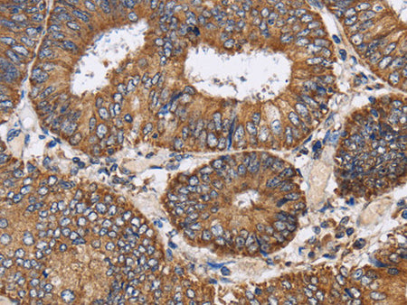 PDGFC Polyclonal Antibody Store at -20°C