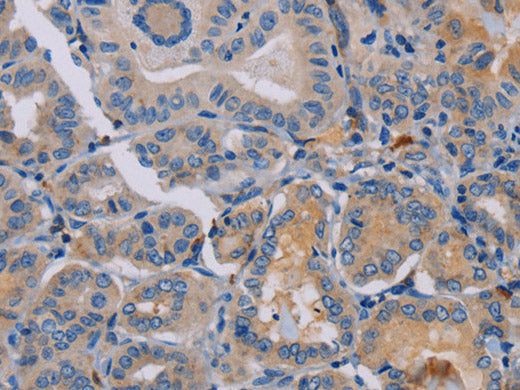 PYY Polyclonal Antibody Store at -20°C
