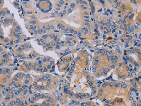 PYY Polyclonal Antibody Store at -20°C