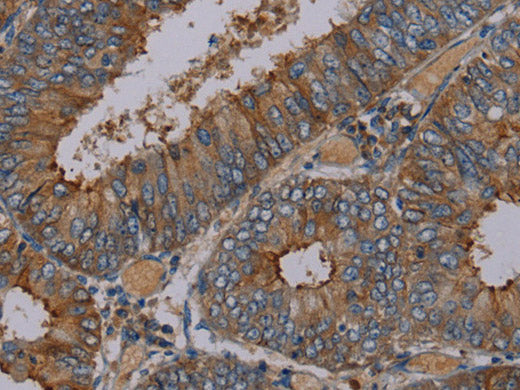 PYY Polyclonal Antibody Store at -20°C