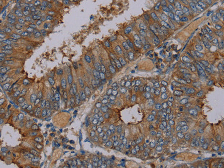 PYY Polyclonal Antibody Store at -20°C