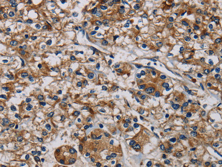 PLIN3 Polyclonal Antibody Store at -20°C