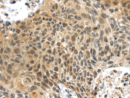 PLIN3 Polyclonal Antibody Store at -20°C
