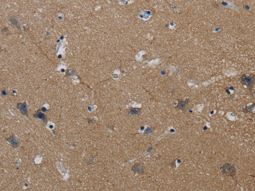 PIK3CG Polyclonal Antibody Store at -20°C