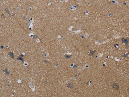 PIK3CG Polyclonal Antibody Store at -20°C