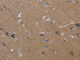 PIK3CG Polyclonal Antibody Store at -20°C