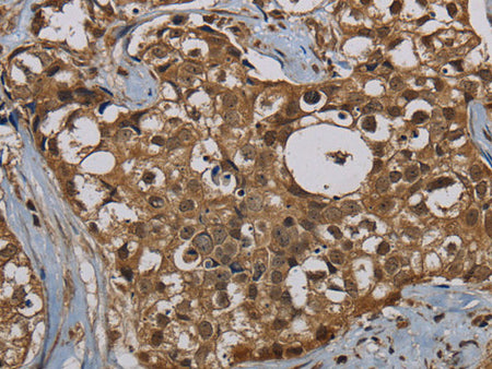 PNN Polyclonal Antibody Store at -20°C