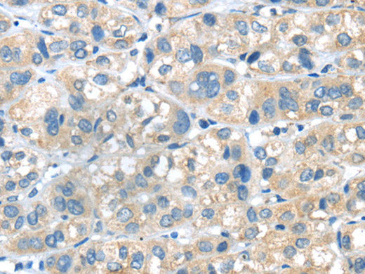 PLXNA2 Polyclonal Antibody Store at -20°C