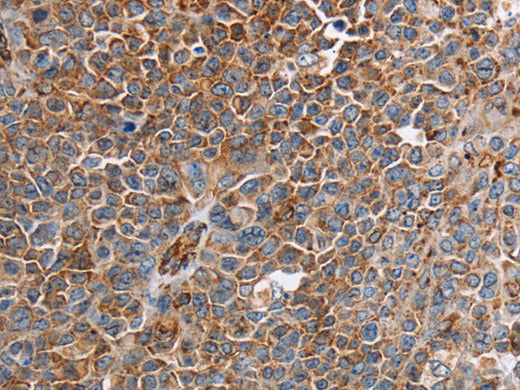 PLXNA2 Polyclonal Antibody Store at -20°C
