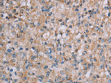 PLXNA4 Polyclonal Antibody Store at -20°C