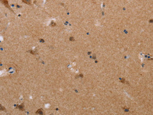 PLXNA4 Polyclonal Antibody Store at -20°C