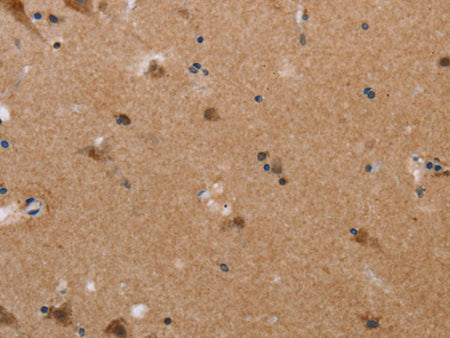 PLXNA4 Polyclonal Antibody Store at -20°C