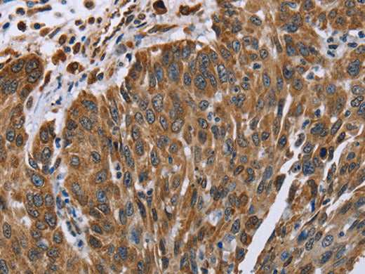 PLXNB1 Polyclonal Antibody Store at -20°C