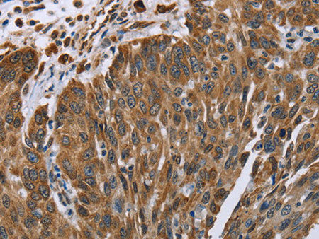 PLXNB1 Polyclonal Antibody Store at -20°C
