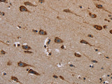 PLXNB1 Polyclonal Antibody Store at -20°C