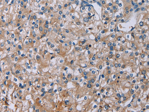 PLXND1 Polyclonal Antibody Store at -20°C
