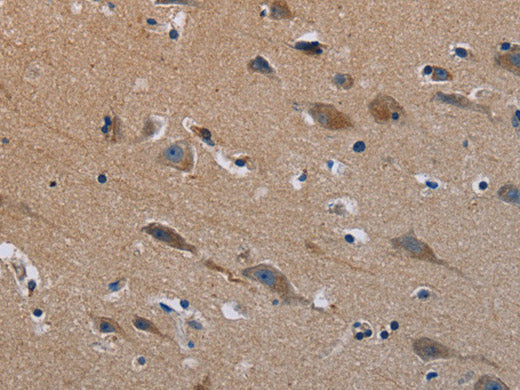 PLXND1 Polyclonal Antibody Store at -20°C