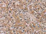 POMT1 Polyclonal Antibody Store at -20°C